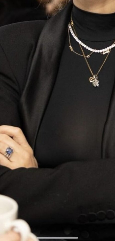 Emmerdales Charley Webb