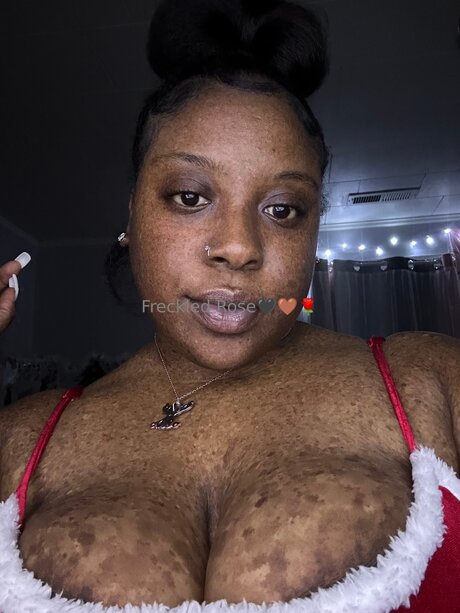 Freckledfantasy5