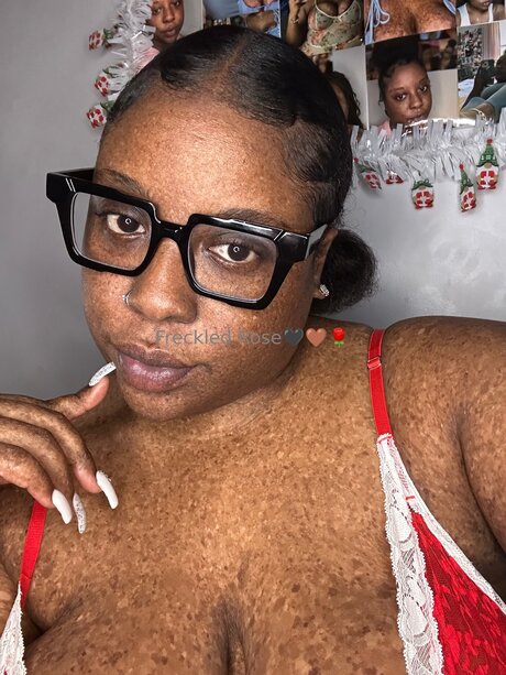 Freckledfantasy5