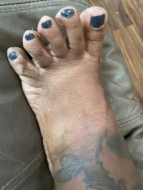 Ugly Feet
