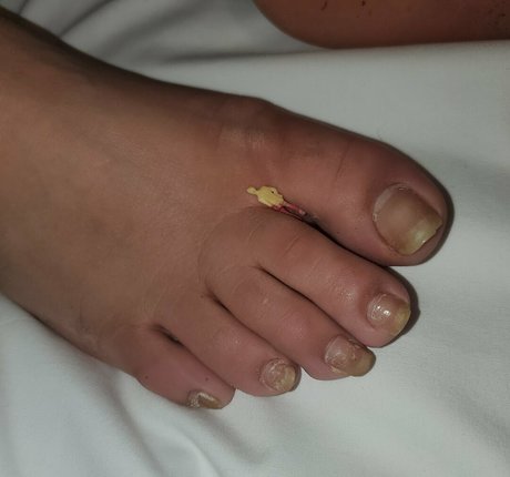 Missfeetstinkvip