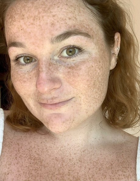 Freckled Baby