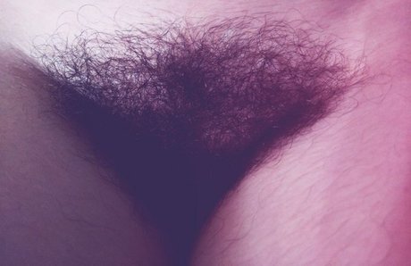 Hairy Women