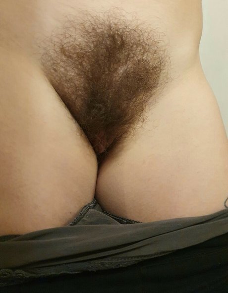 Hairy Women